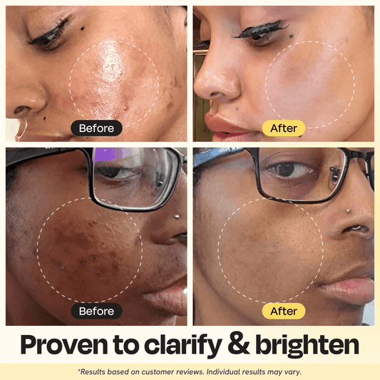 Masque à l'argile et à la vitamine C